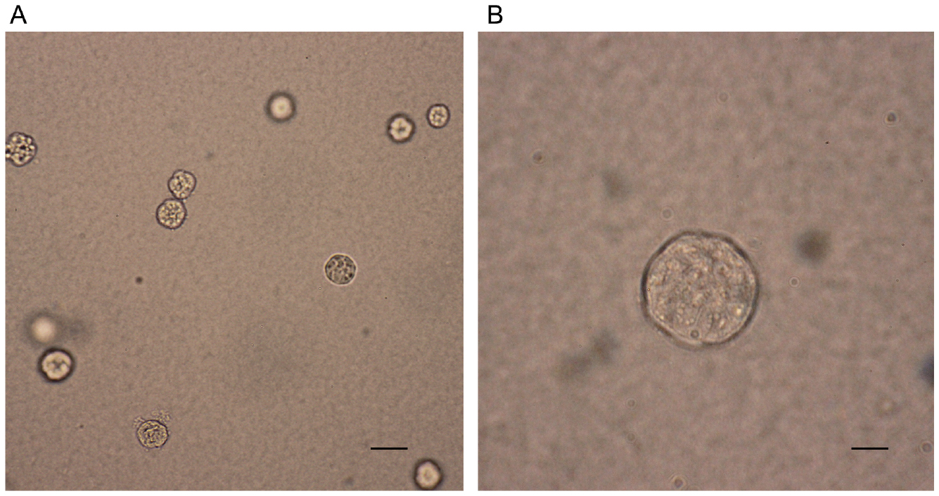 Soft Agar Colony Formation Assay As A Hallmark Of Carcinogenesis BIO