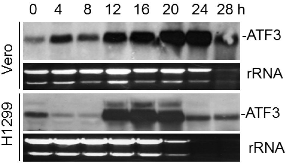 Rna Isolation And Northern Blot Analysis Bio Protocol