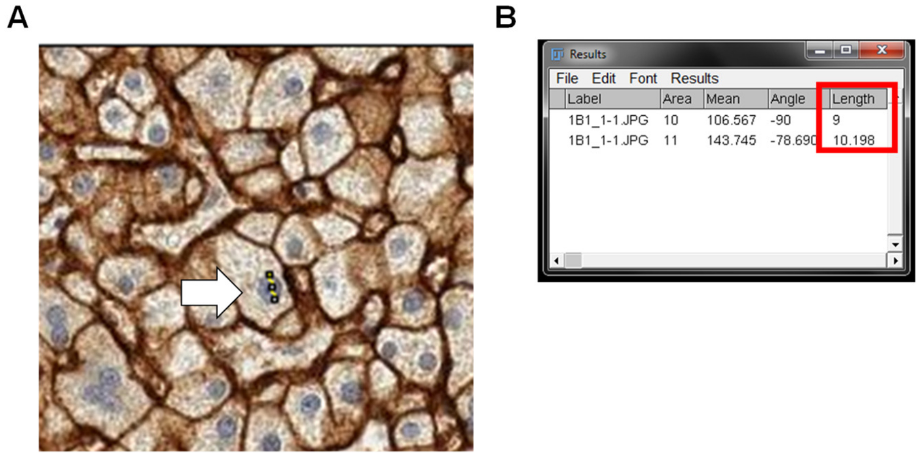 Semi Quantitative Determination Of Protein Expression Using