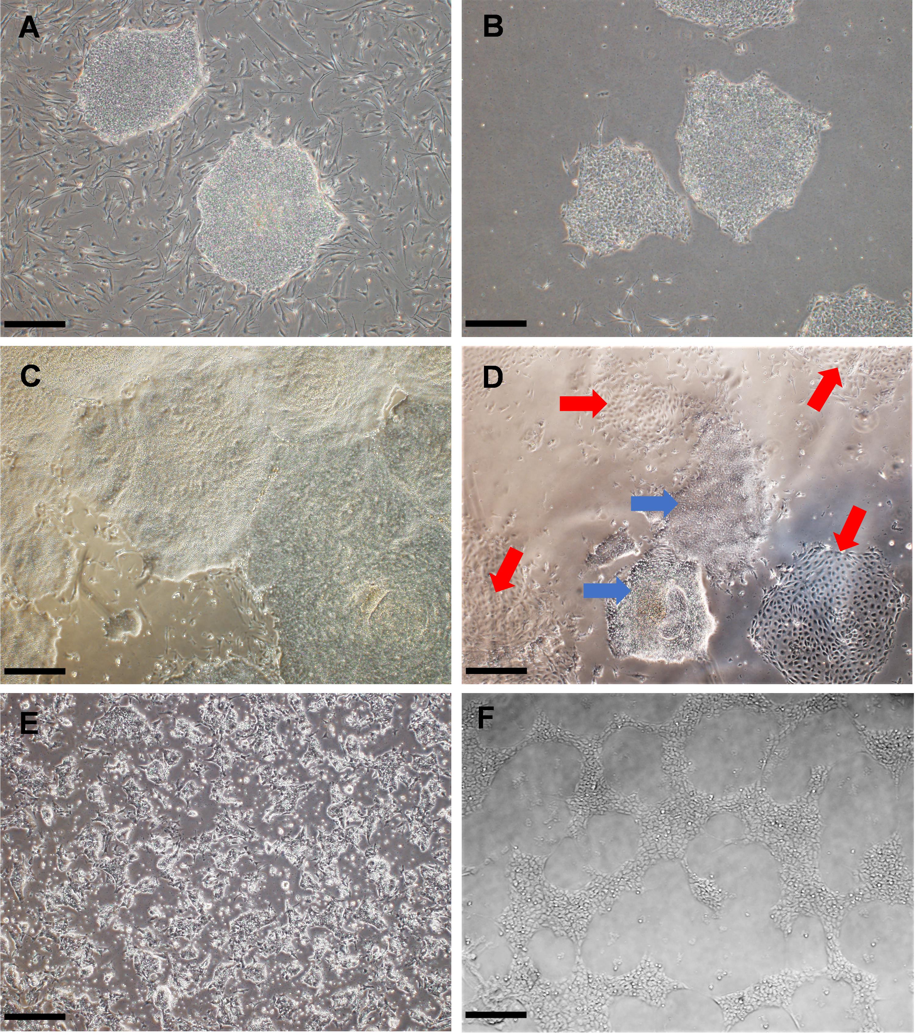 Rapid And Simplified Induction Of Neural Stem Progenitor Cells NSCs