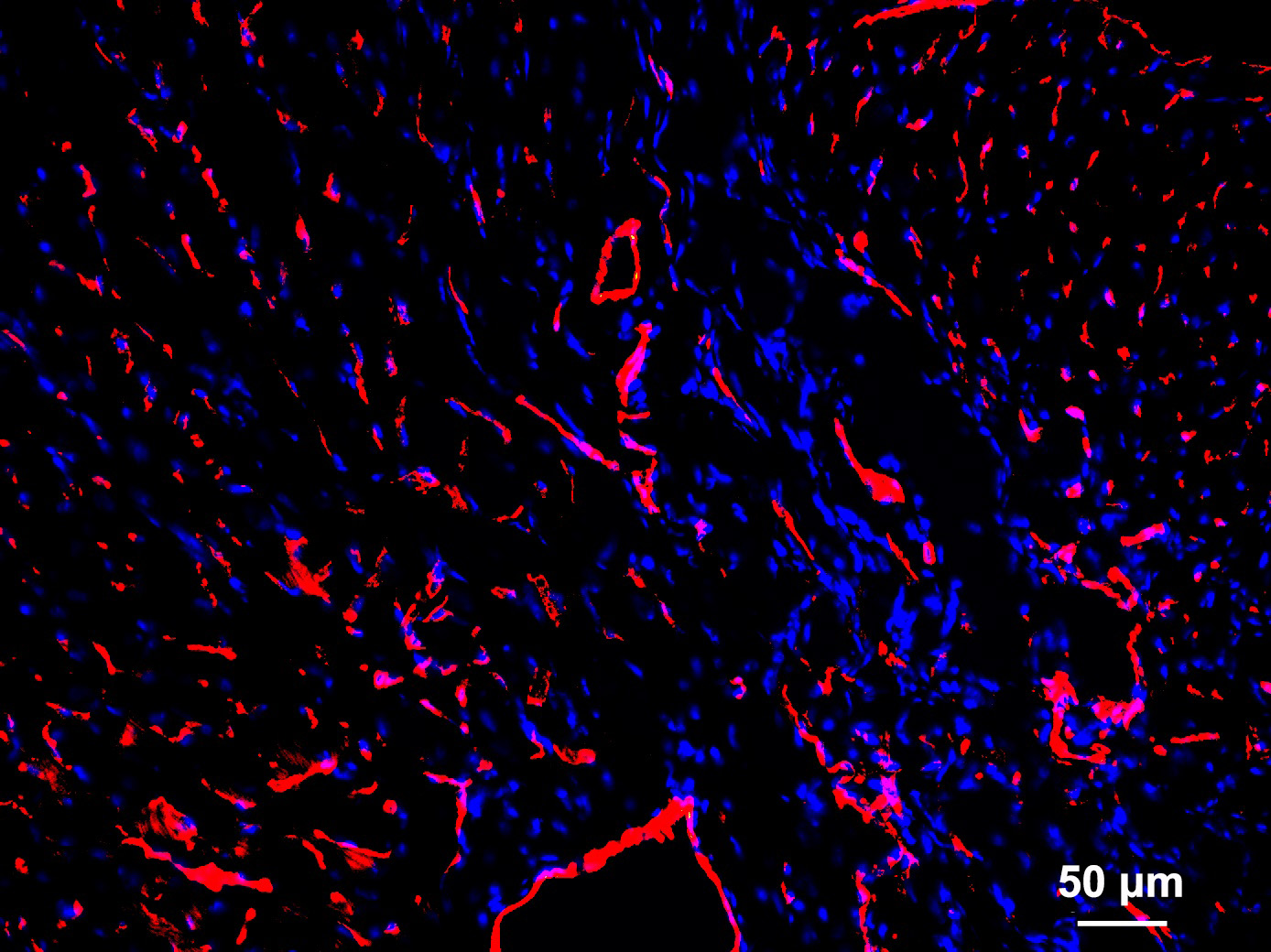 20191021-IR-Sr-4W-816-CD31-cTnT-20X-1_c1+3