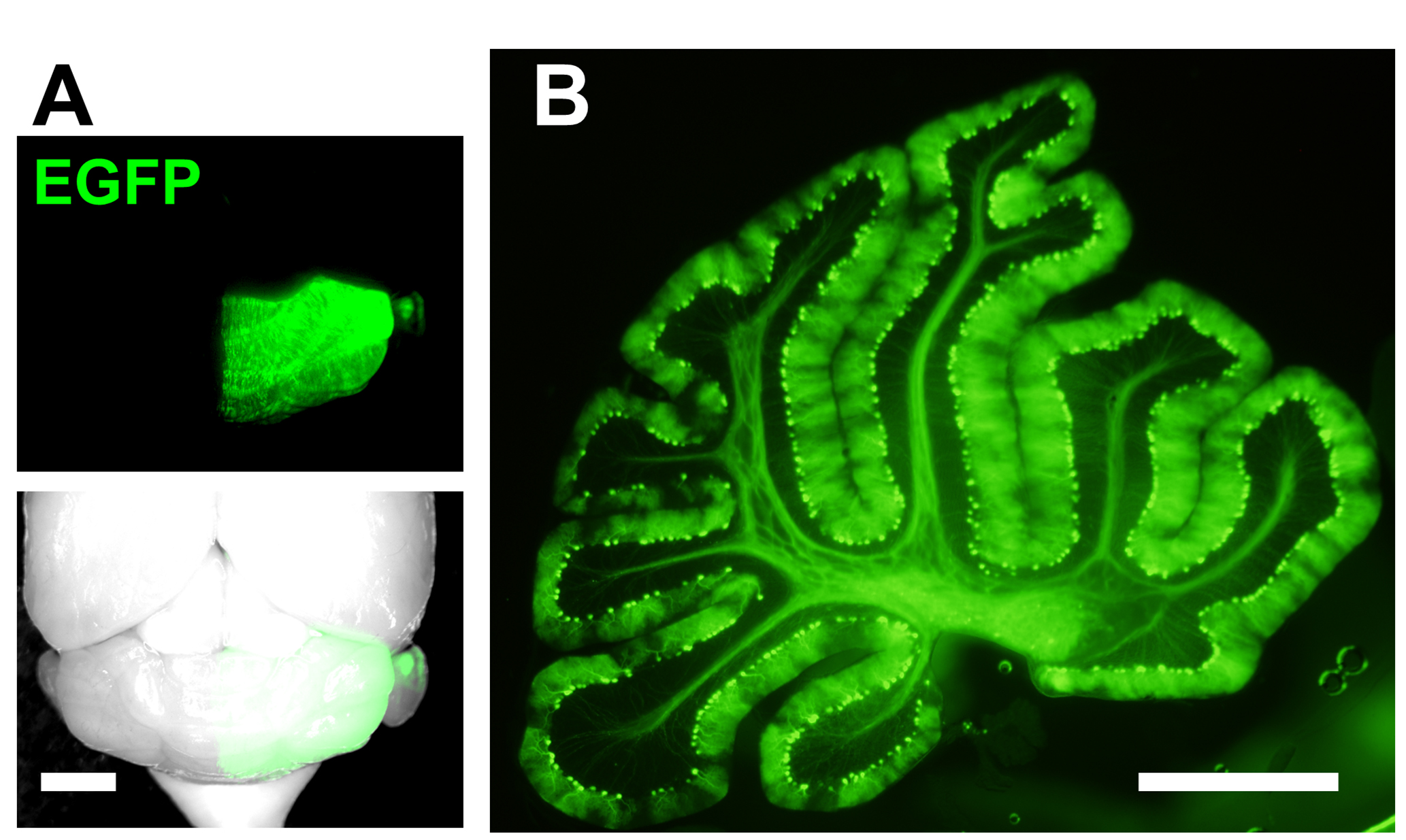 In Utero Electroporation Of Mouse Cerebellar Purkinje Cells —bio Protocol 8136