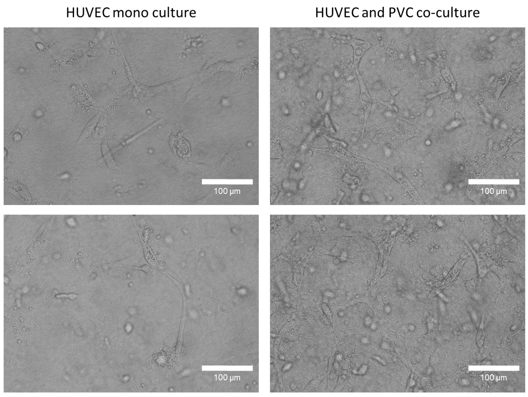 Huvec Cell Culture Media Shop Deals | www.gbu-presnenskij.ru