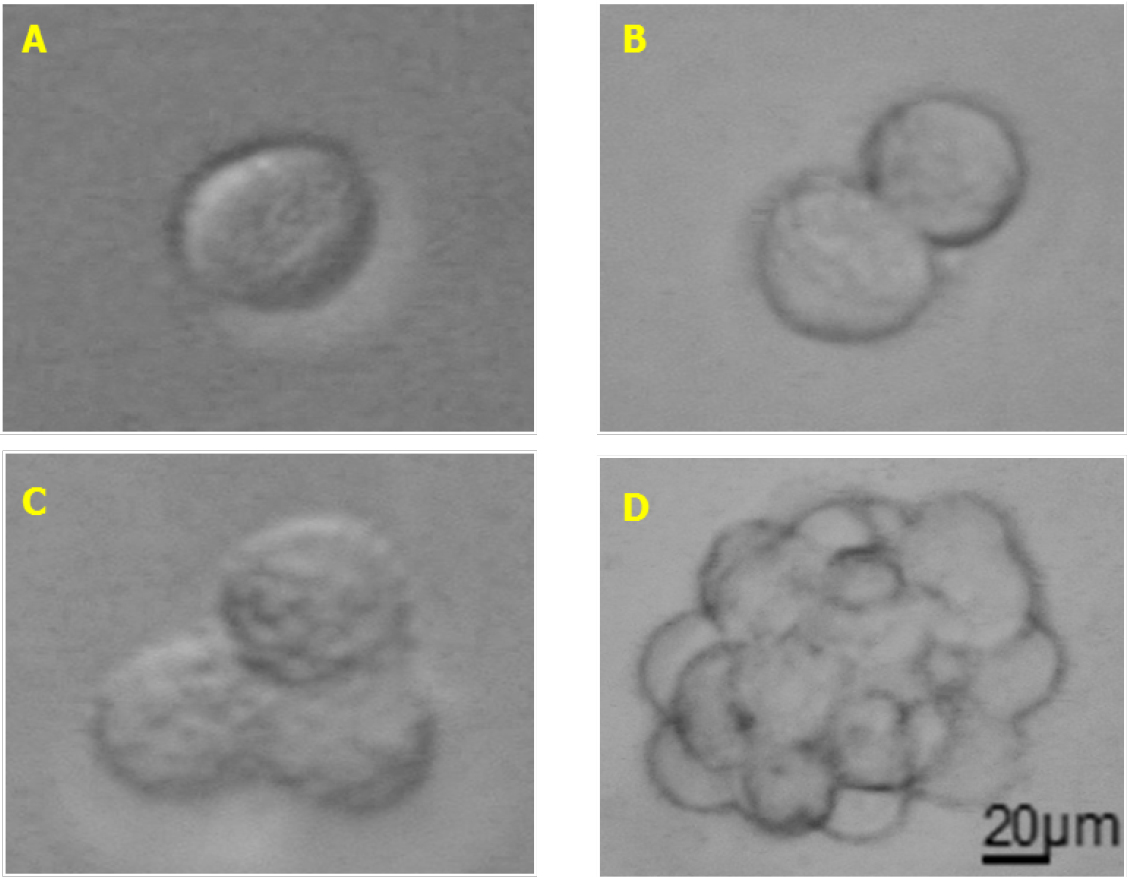 Melanoma Stem Cell Sphere Formation Assay —bio Protocol