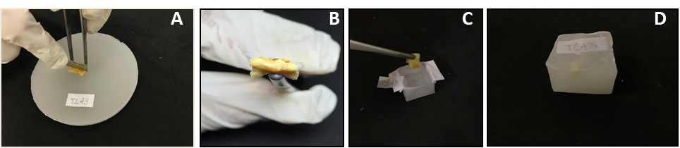 Morphological Evaluation Of Wound Healing Events In The Excisional Wound Healing Model In Rats