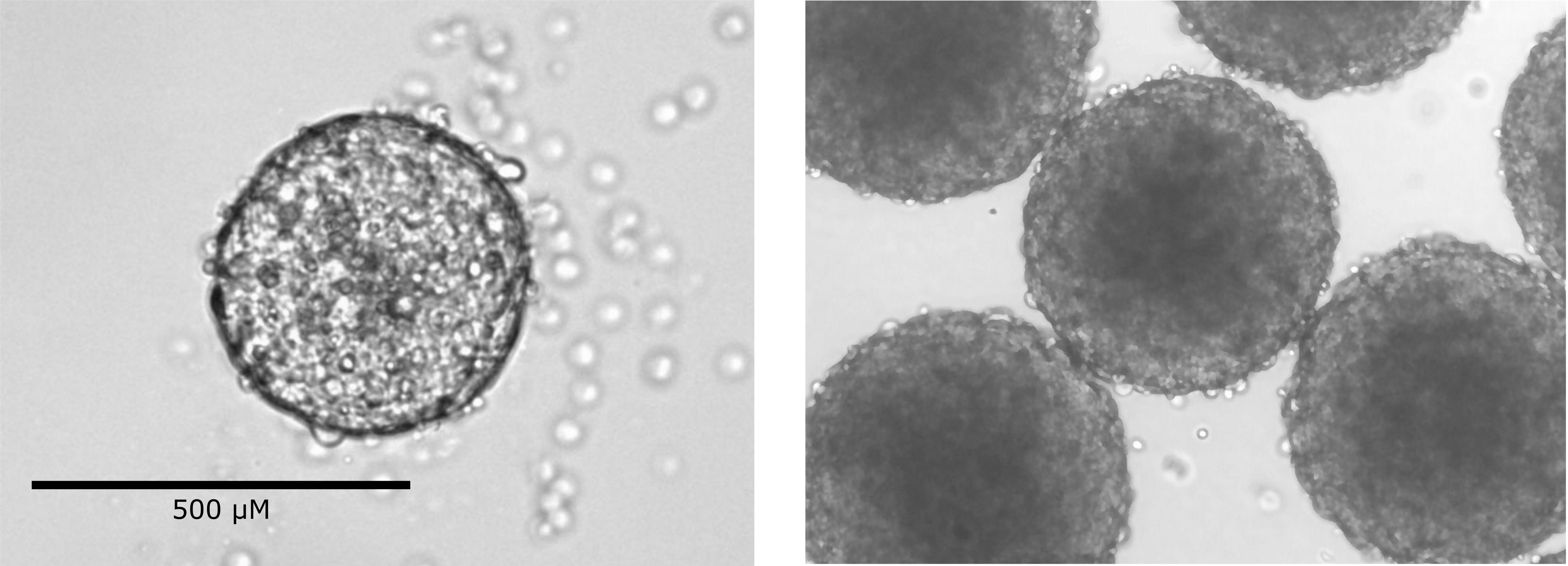 Figure 2. Typical morphology of embryoid body. v6.5 cells were cultured ...