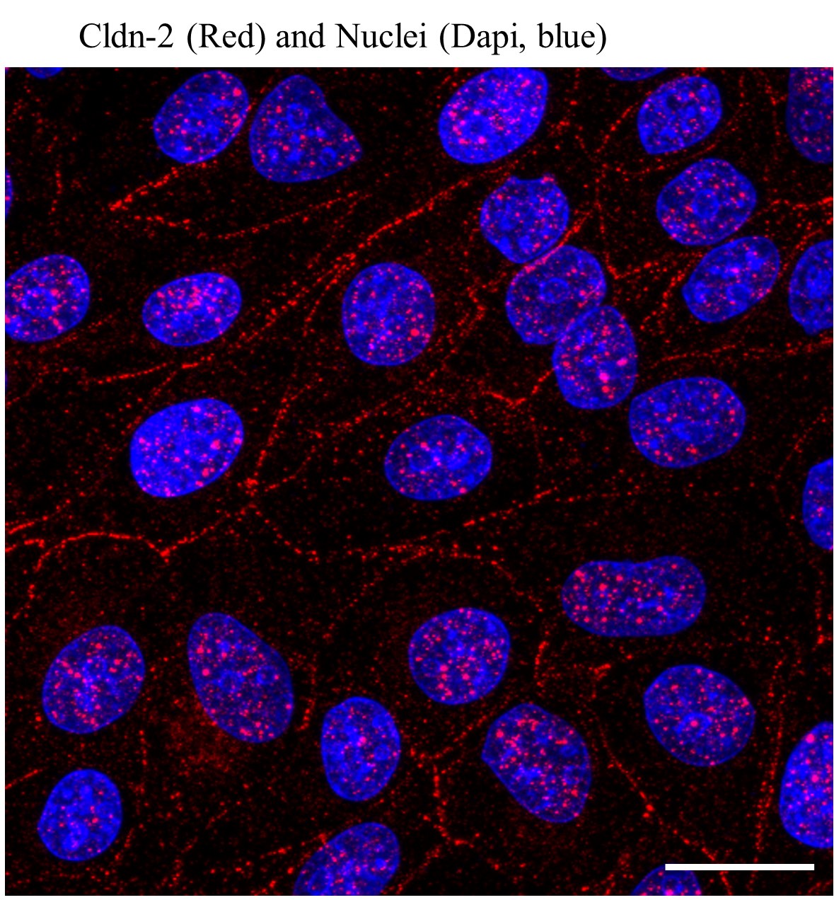 Immunofluorescent Staining of Claudin-2 in Cultured Kidney Tubular ...