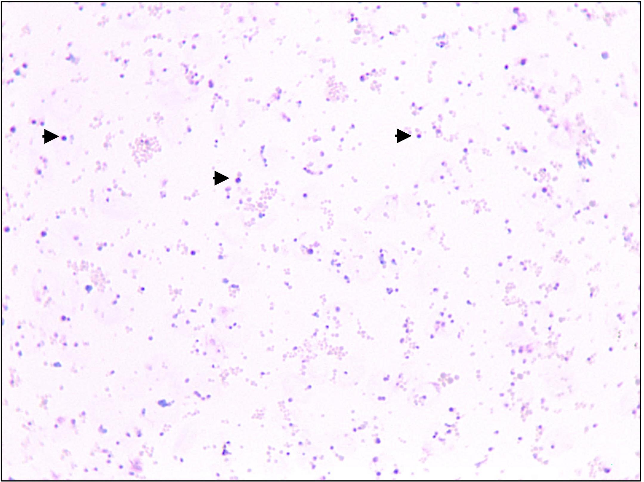 Babesia duncani in Culture and in Mouse (ICIM) Model for the ...