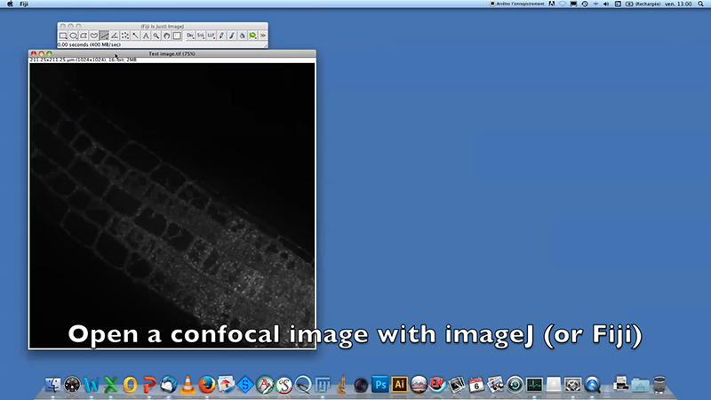 Procedure to estimate the size of the compartments of interest