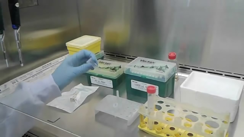 Electroporation of T. cruzi epimastigotes