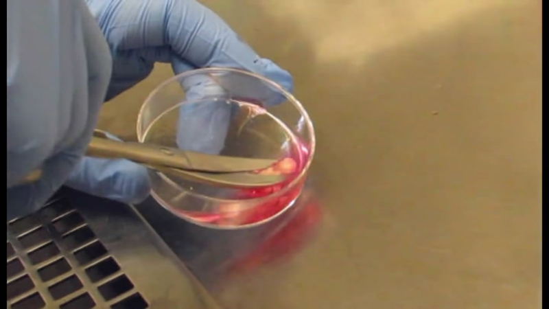 Mincing of adipose tissue