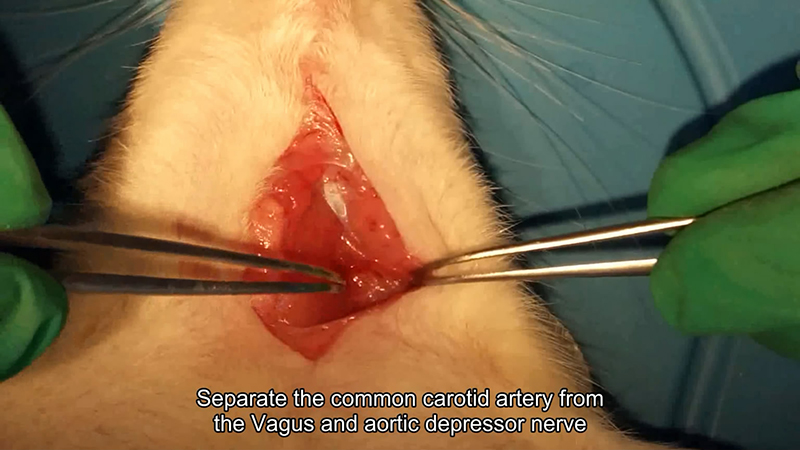Separate the common carotid artery from the Vagus and aortic depressor nerve