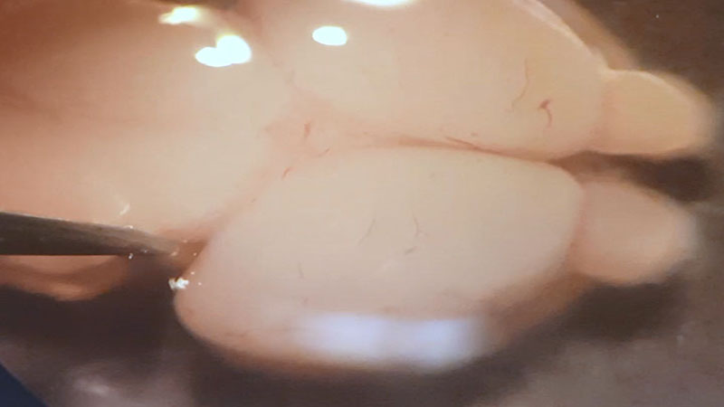 Isolation of striatum from embryonic E16 mouse brain