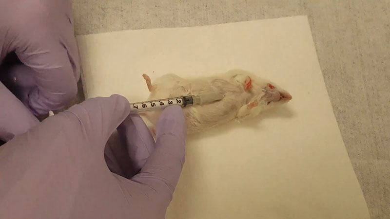Cardiac puncture