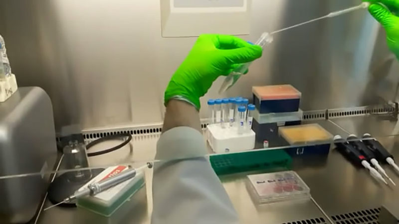 Electroporation procedure