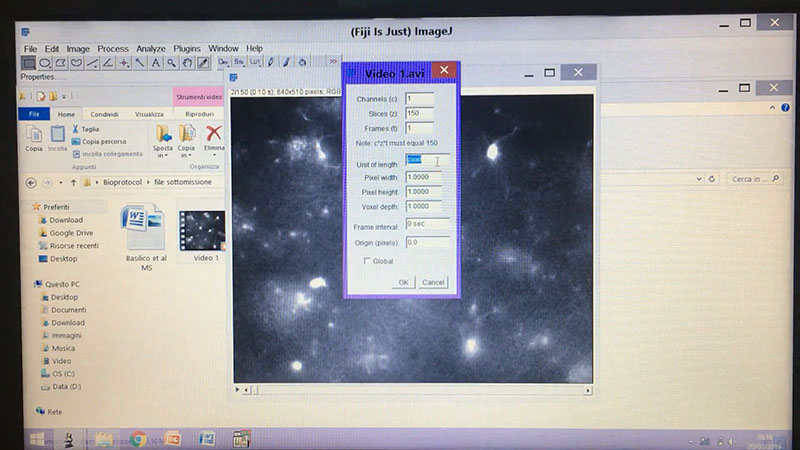 Tracking of microglial processes.