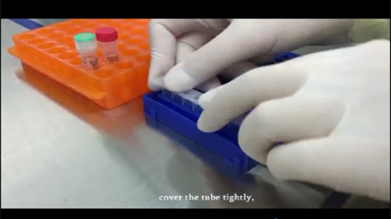COVID-19 Nucleic Acid Detection