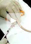 Pain Assessment Using the Rat and Mouse Formalin Tests