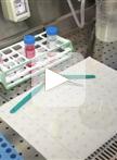 Glioma Associated Stem Cells (GASCs) Isolation and Culture