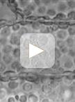 Observation of Chloroplast Movement in Vallisneria
