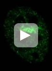 Laser Microirradiation and Temporal Analysis of XRCC1 Recruitment to Single-strand DNA Breaks