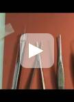 小鼠乳腺管内（MIND）法移植病人来源的原代DCIS细胞和细胞系