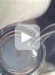 用成纤维细胞对胃癌细胞进行三维凝胶侵袭试验