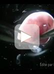 Analysis of Enteric Neural Crest Cell Migration Using Heterotopic Grafts of Embryonic Guts
