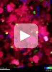 In vivo Imaging of Tumor and Immune Cell Interactions in the Lung