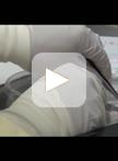 Establishment of Patient-Derived Xenografts in Mice