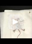 Vascular Smooth Muscle Cell Isolation and Culture from Mouse Aorta