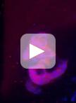 Lentiviral shRNA Screen to Identify Epithelial Integrity Regulating Genes in MCF10A 3D Culture