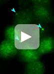 Physical Removal of the Midbody Remnant from Polarised Epithelial  Cells Using Take-Up by Suction Pressure (TUSP)