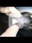 Peripheral Nerve Injury: a Mouse Model of Neuropathic Pain