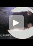 Transplantation of Embryonic Cortical Tissue into Lesioned Adult Brain in Mice