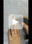 由Akt1驱动的血管肿瘤的新型小鼠皮肤移植模型