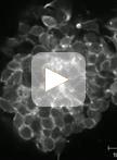 Live Imaging of Myogenesis in Indirect Flight Muscles in Drosophila