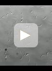 Plasmodium Sporozoite Motility on Flat Substrates