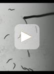 Aldicarb-induced Paralysis Assay to Determine Defects in  Synaptic Transmission in Caenorhabditis elegans