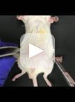 Teratoma Formation Assay for Assessing Pluripotency and  Tumorigenicity of Pluripotent Stem Cells