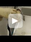 Isolation of Rodent Brain Vessels