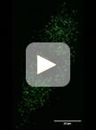 Peroxisome Motility Measurement and Quantification Assay