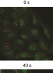 Lysosomal Stability Assay