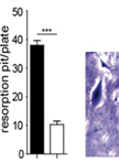 Bone Resorption Assay