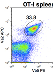 Analysis of Tumor-infiltrating Lymphocytes Following CD45 Enrichment 