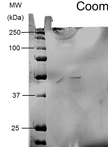Purification and Detection of a PDGA Depolymerase from Pusillimonas noertemannii