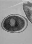 Preparation of Candida albicans Biofilms for Transmission Electron Microscopy