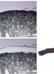 Total RNA Isolation after Laser-capture Microdissection of Human Cervical Squamous Epithelial Cells from Fresh Frozen Tissue 