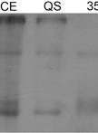 Reverse Zymmogram Analysis for the Detection of Protease Inhibitor Activity