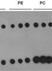 PTEN-lipid Binding Assay